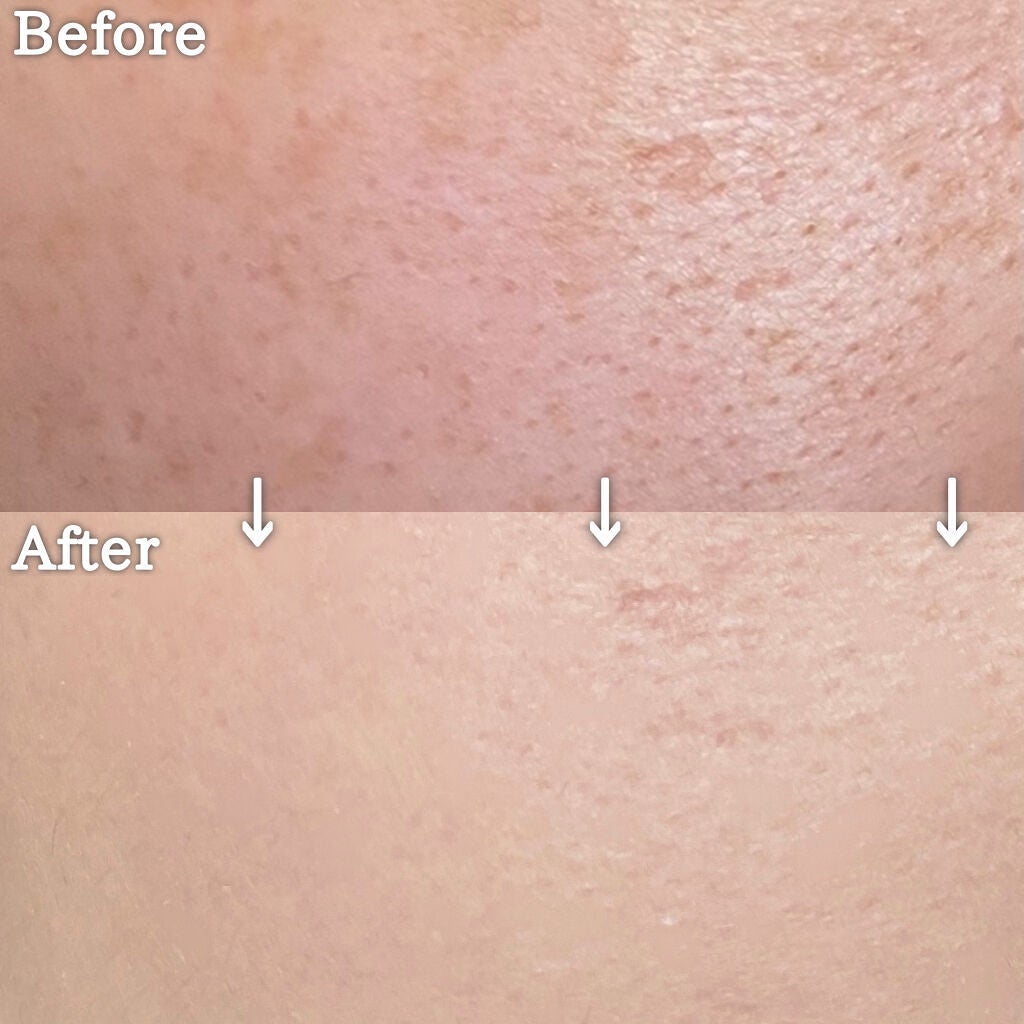 ãªãŒã«ã¢ã¯ãŒãº ãªããã/YVES SAINT LAURENT BEAUTE/ãªããããã¡ã³ããŒã·ã§ã³ã䜿ã£ãã¯ãã³ãïŒ6æç®ïŒ