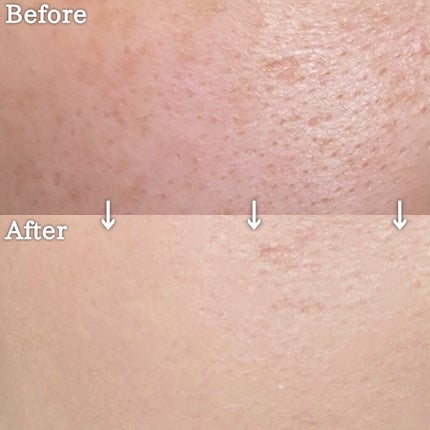 ãªãŒã«ã¢ã¯ãŒãº ãªããã/YVES SAINT LAURENT BEAUTE/ãªããããã¡ã³ããŒã·ã§ã³ã䜿ã£ãã¯ãã³ãïŒ6æç®ïŒ