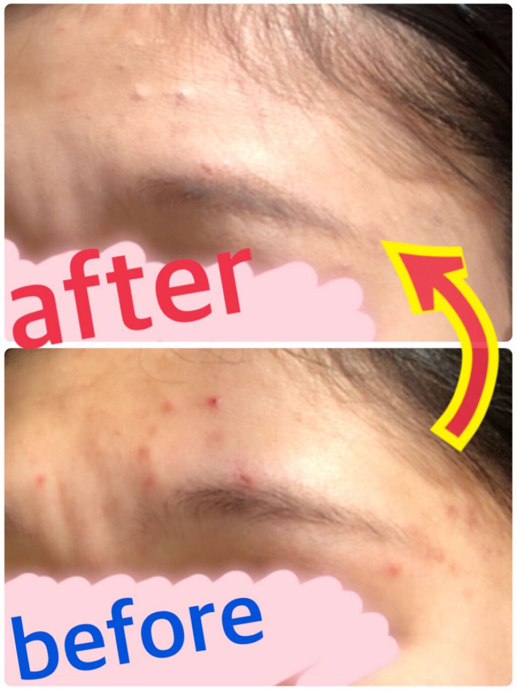 カバーパーフェクション チップコンシーラー/the SAEM/リキッドコンシーラーを使ったクチコミ（3枚目）