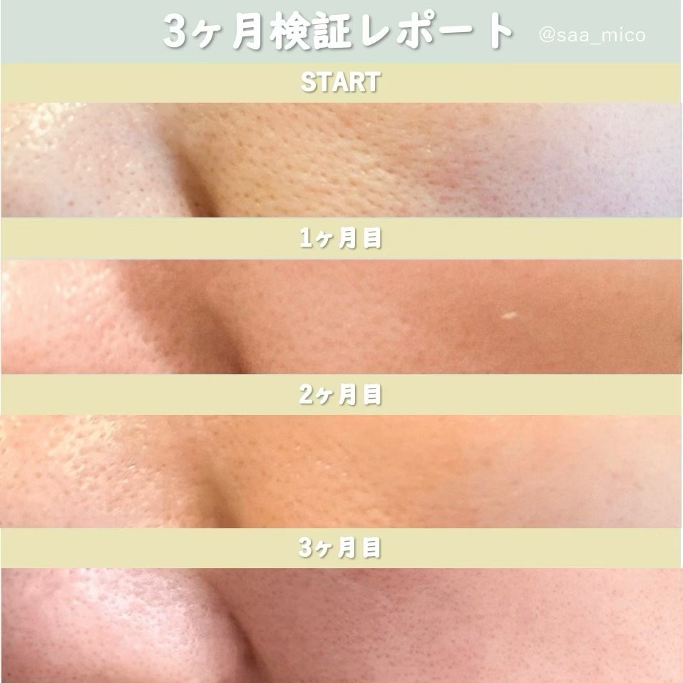 シカレチA エッセンス0.1/VT/美容液を使ったクチコミ(7枚目)