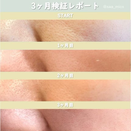 シカレチA エッセンス0.1/VT/美容液を使ったクチコミ(7枚目)