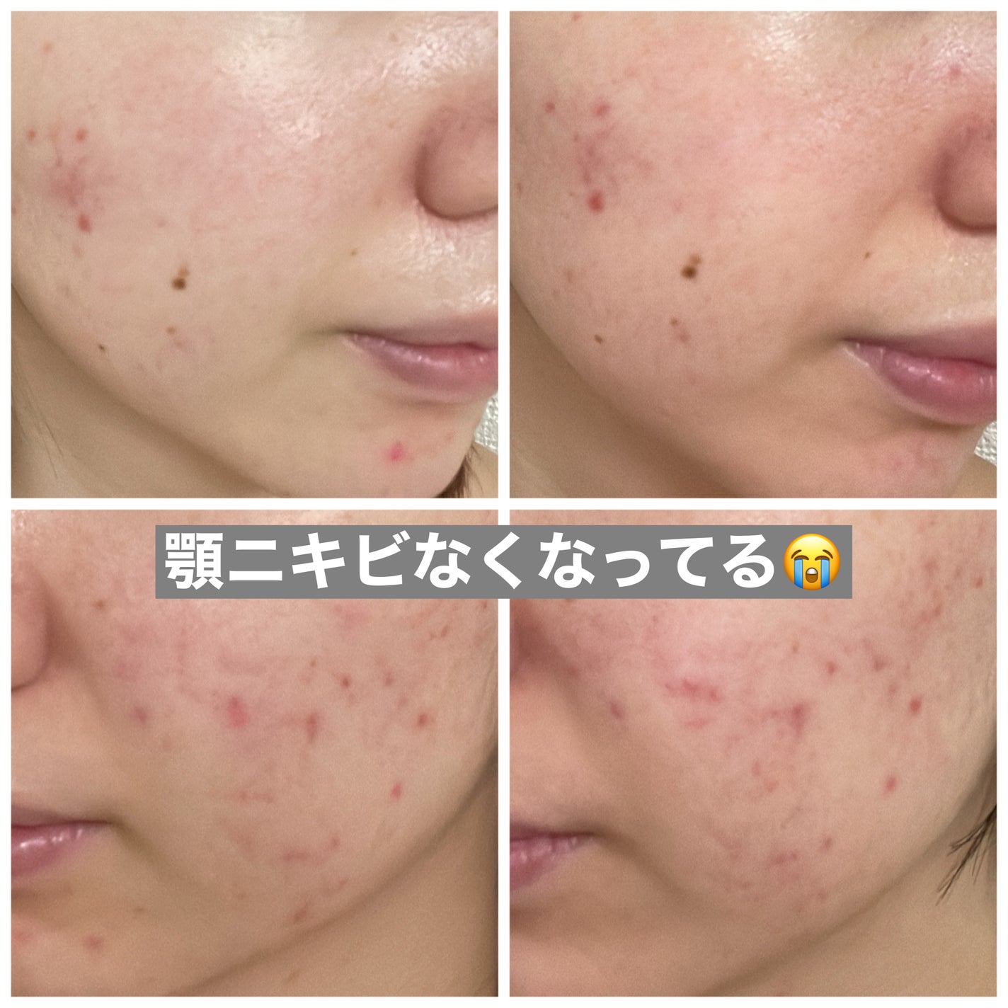 クリアフル ローションM(しっとりタイプ)/オルビス/化粧水を使ったクチコミ(2枚目)