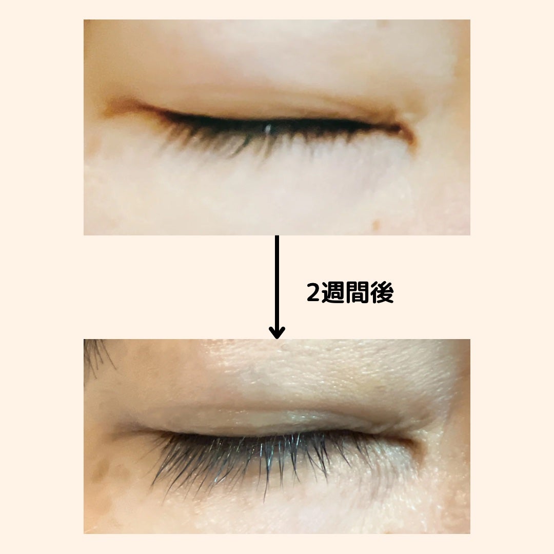 ロングアクティブアイラッシュセラム/COSNORI/まつげ美容液を使ったクチコミ(10枚目)