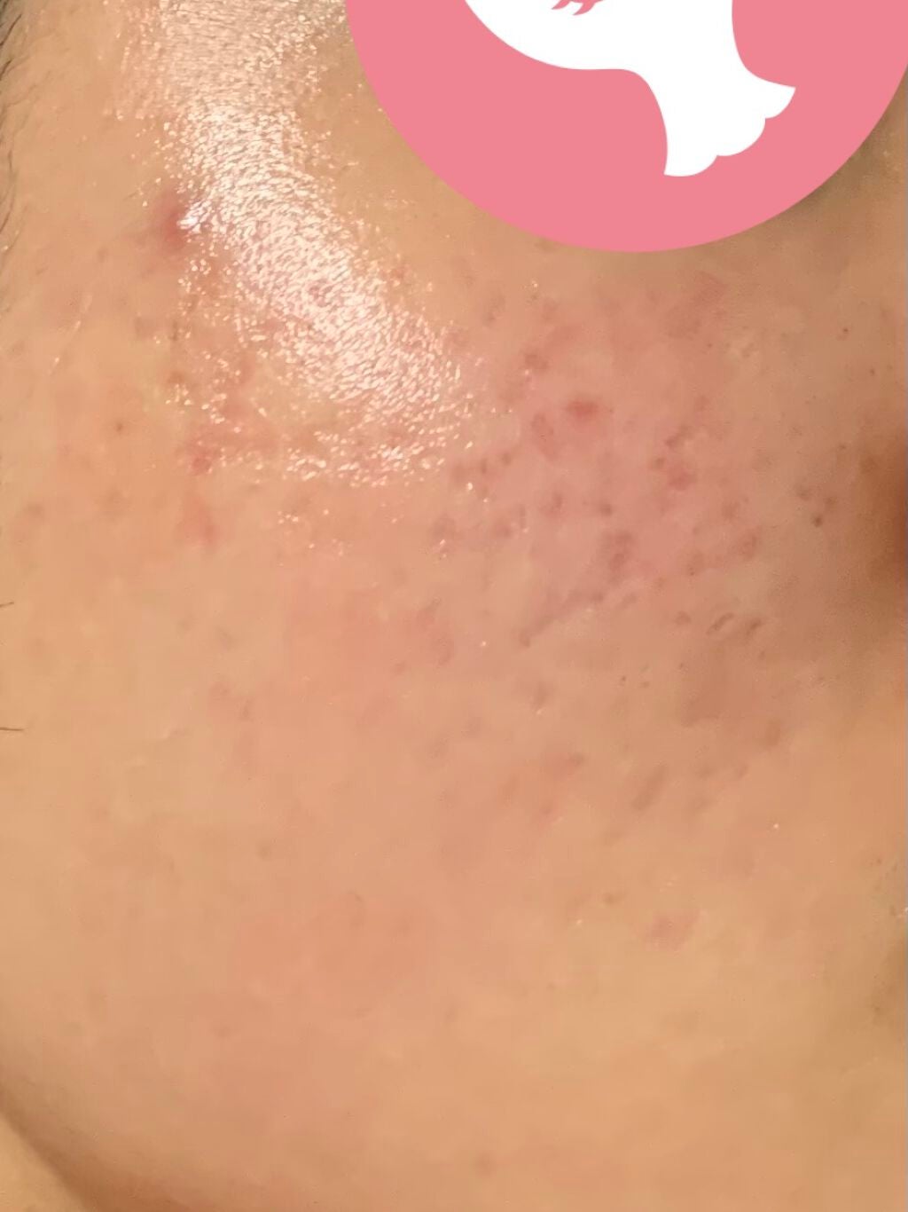 美白化粧水 VC/ちふれ/化粧水を使ったクチコミ(3枚目)