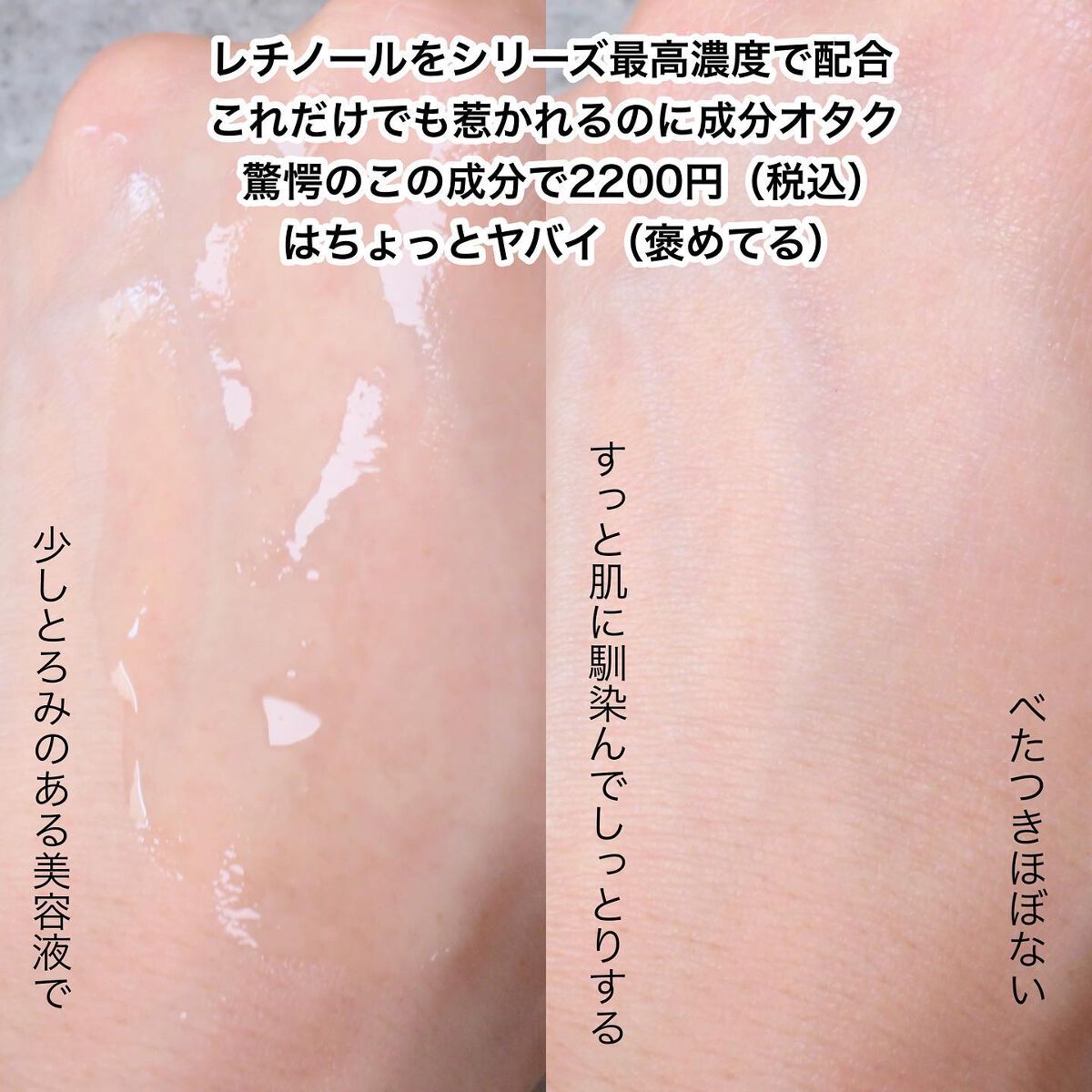 ダーマレーザー R100ジェルクリーム/クオリティファースト/フェイスクリームを使ったクチコミ（3枚目）