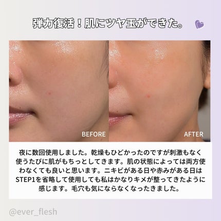 プロバイオダーム™ コラーゲン リモデリング ブースターショット プログラム/BIOHEAL BOH/美容液を使ったクチコミ(6枚目)