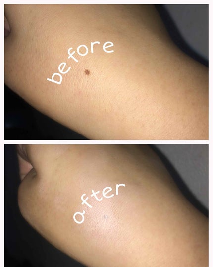 マジックコンシーラー/カリプソ/リキッドコンシーラーを使ったクチコミ(4枚目)