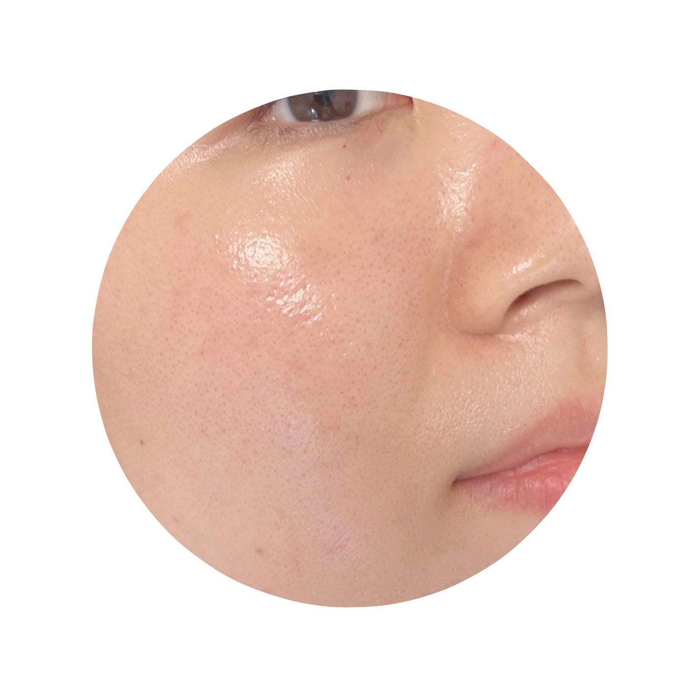 ポアフィットウォータートナー/Feld Apotheke/化粧水を使ったクチコミ(5枚目)