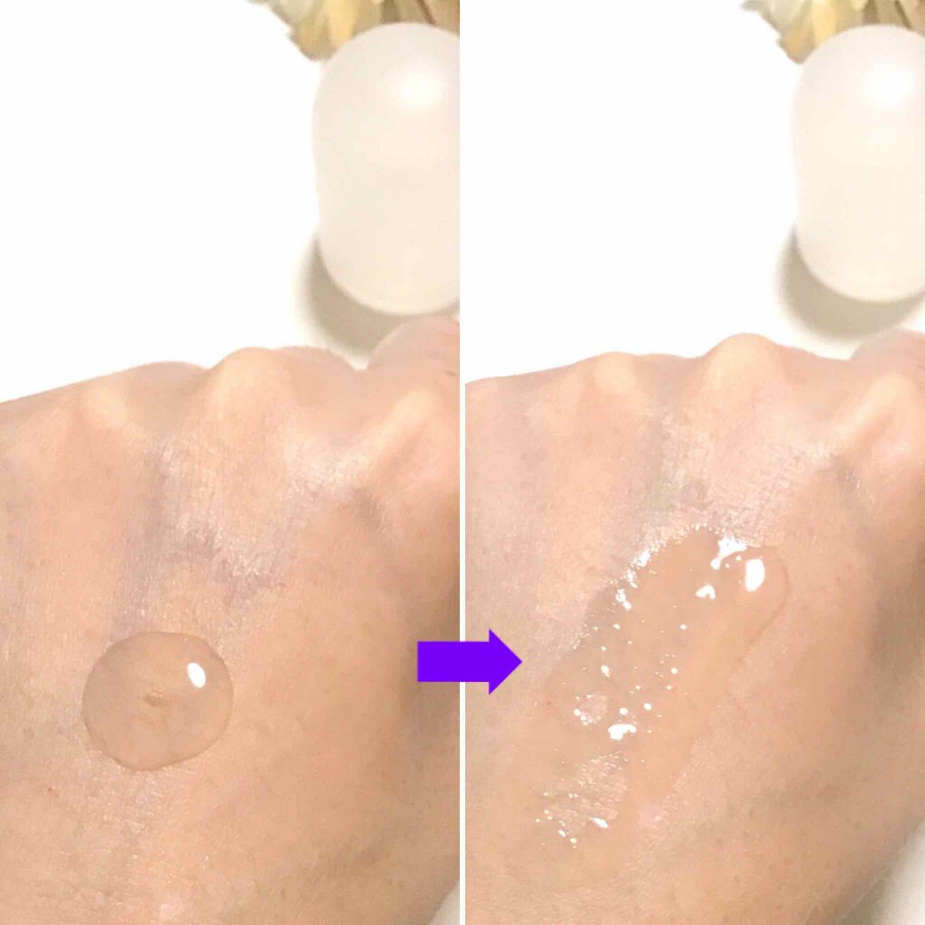 モイストケア ローション MB/d プログラム/化粧水を使ったクチコミ(3枚目)