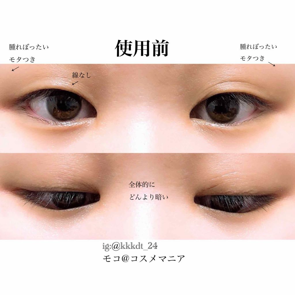 グラン アイ セラム/CLARINS/アイケア・アイクリームを使ったクチコミ（3枚目）