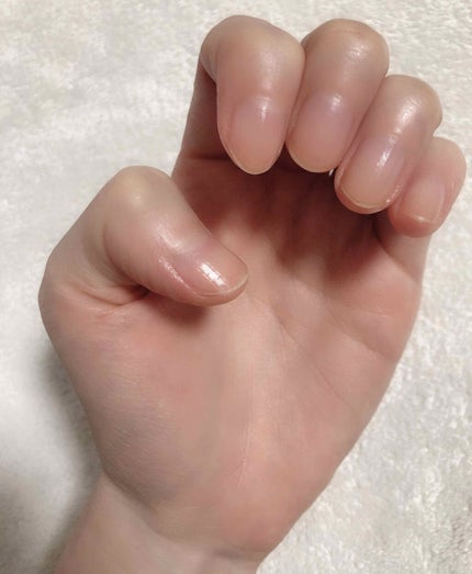 デイケアオイル/Dr.Nail/ネイルオイル・トリートメントを使ったクチコミ(4枚目)