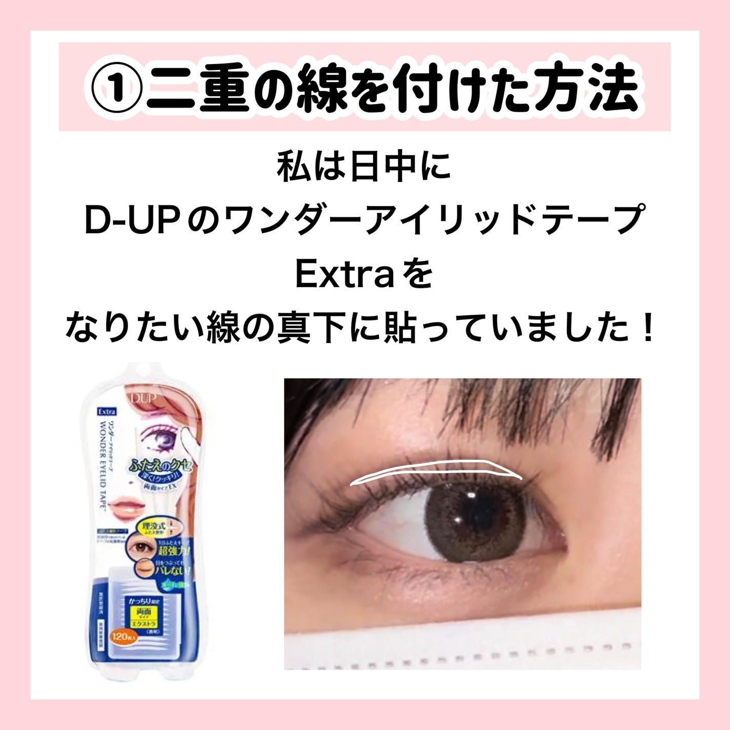 ð¥ð¶ð»ðžð® on LIPS ããæŽåœ¢ãªãã§ãã«ç®ã«ã誰ã§ã確å®ã«å¯æããªããç®ã®ã±ã£ã¡ãè¡ã¯..ãïŒ3æç®ïŒ