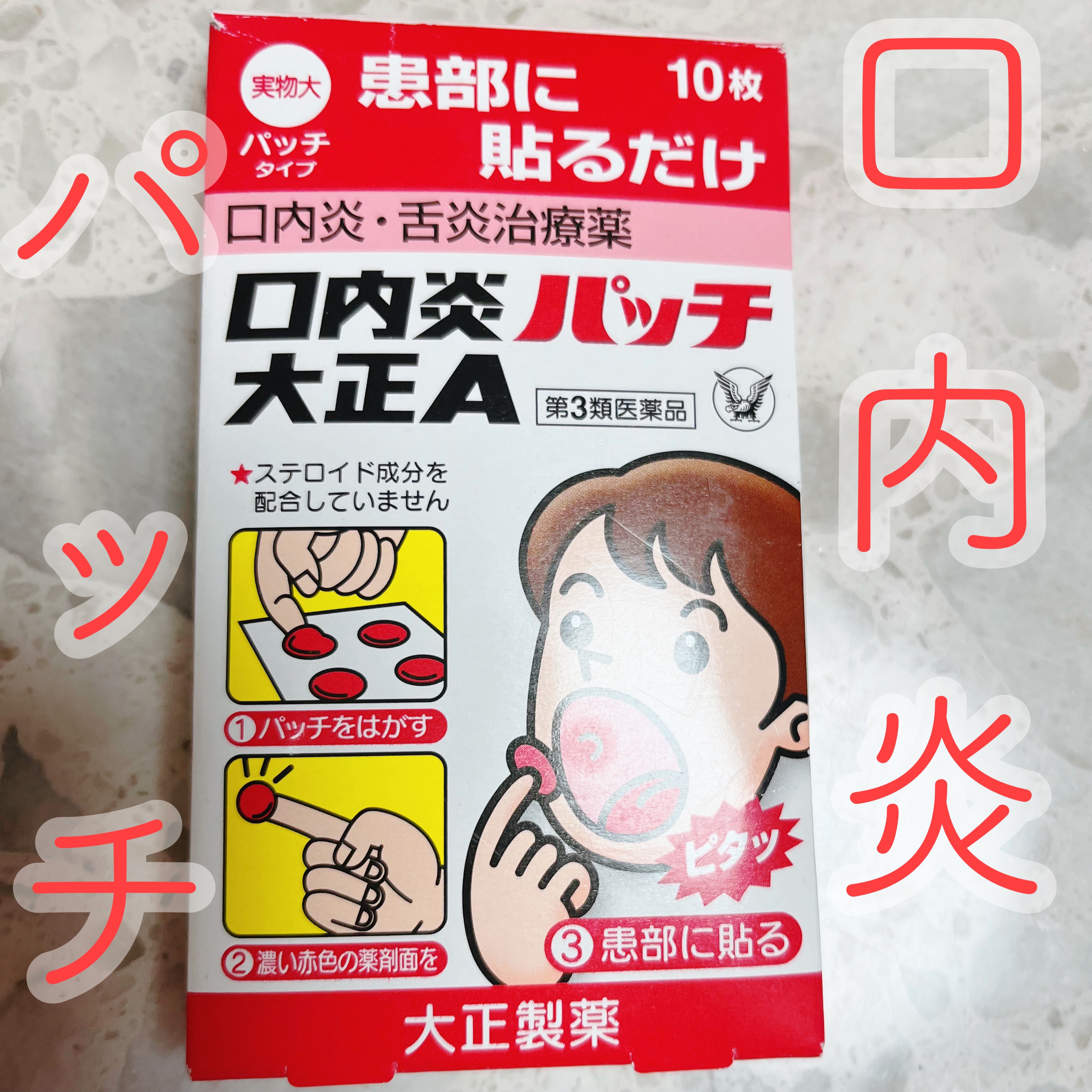 口内炎パッチ大正A（医薬品）/大正製薬/その他を使ったクチコミ（1枚目）