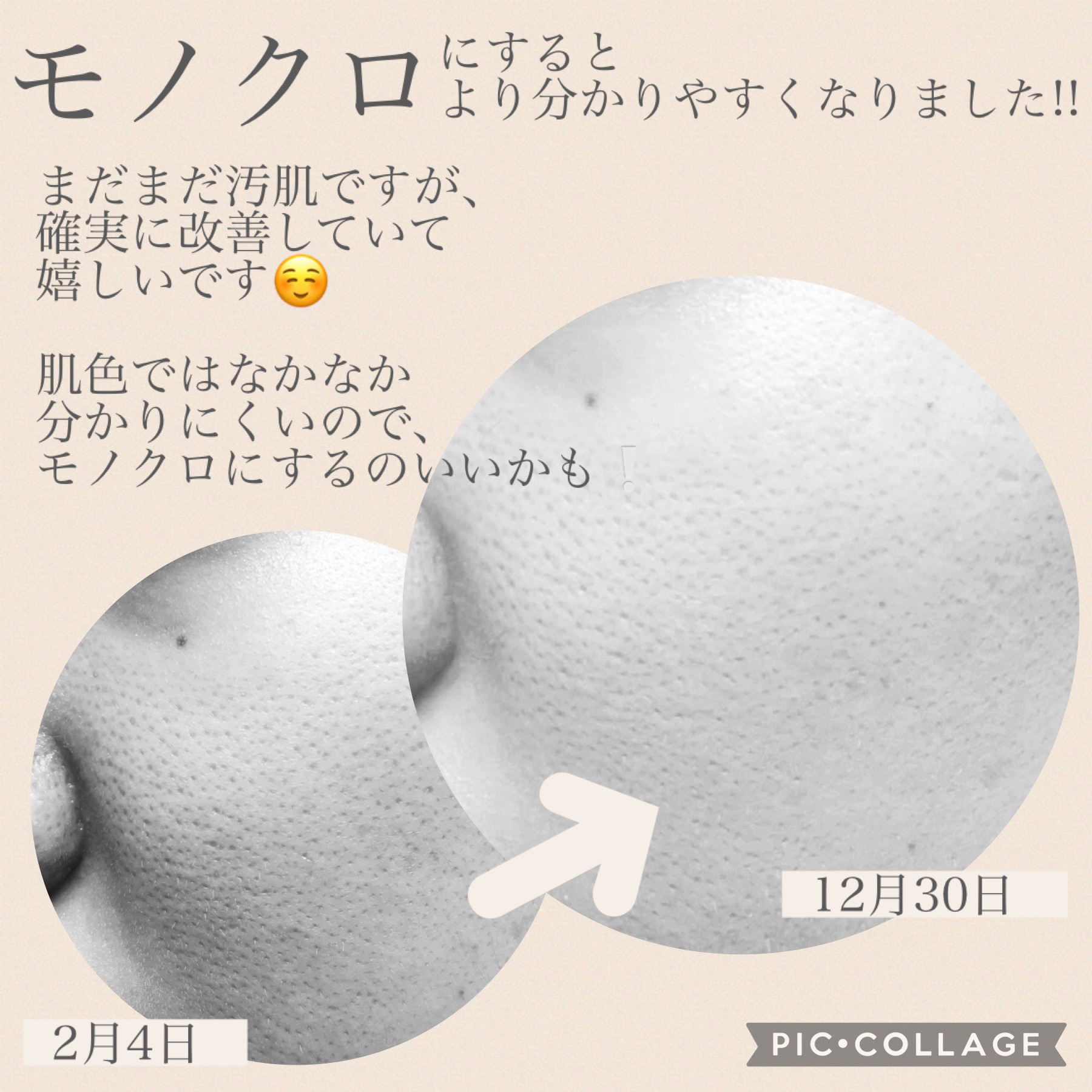 レッドB・Cスージングクリーム(チューブタイプ)/Dr.G/フェイスクリームを使ったクチコミ（2枚目）