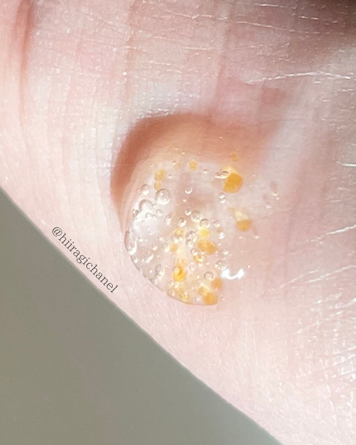 デイリーバイタライズカプセルセラム/SAM'U/美容液を使ったクチコミ(4枚目)