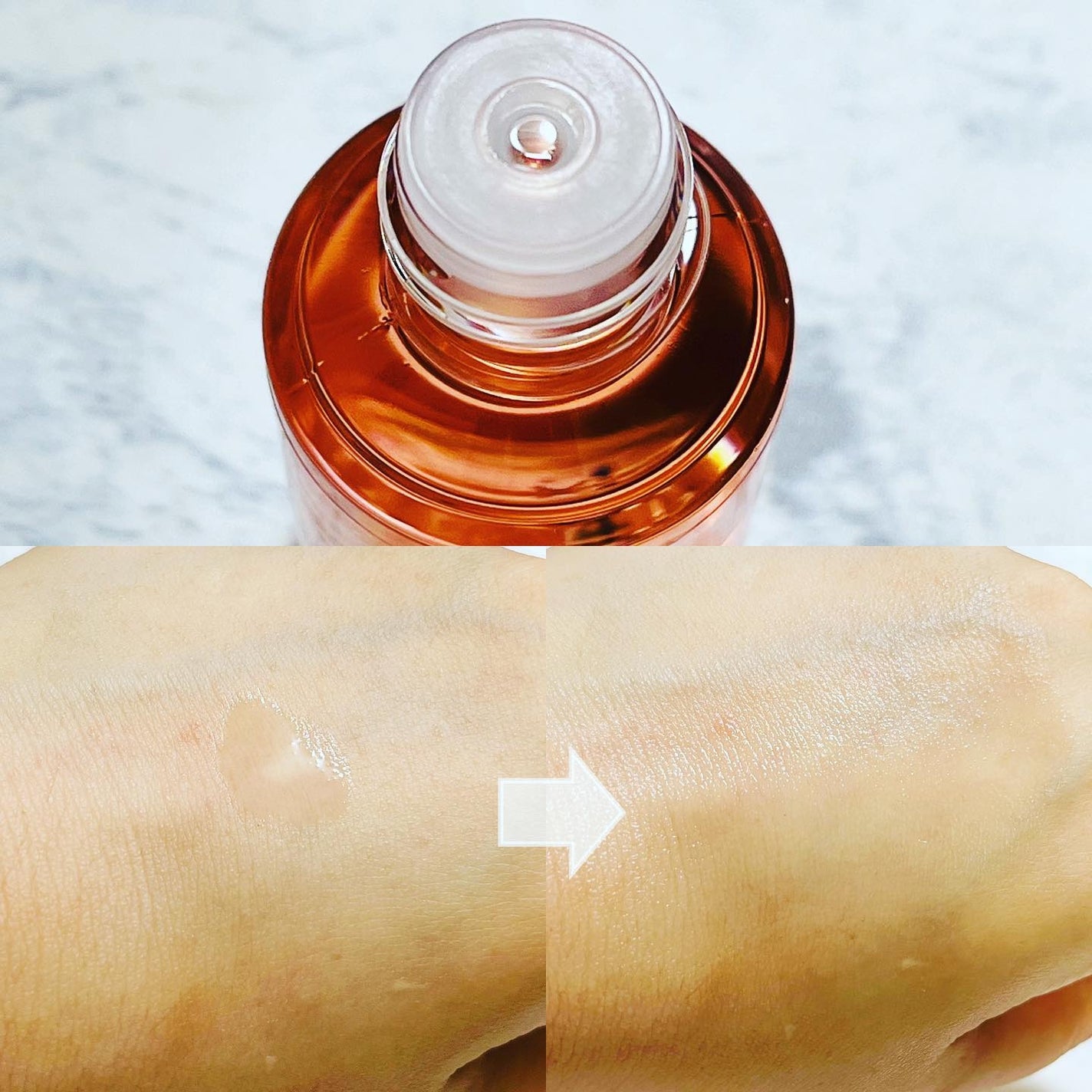 バイオイル/バイオイル/フェイスオイルを使ったクチコミ(2枚目)