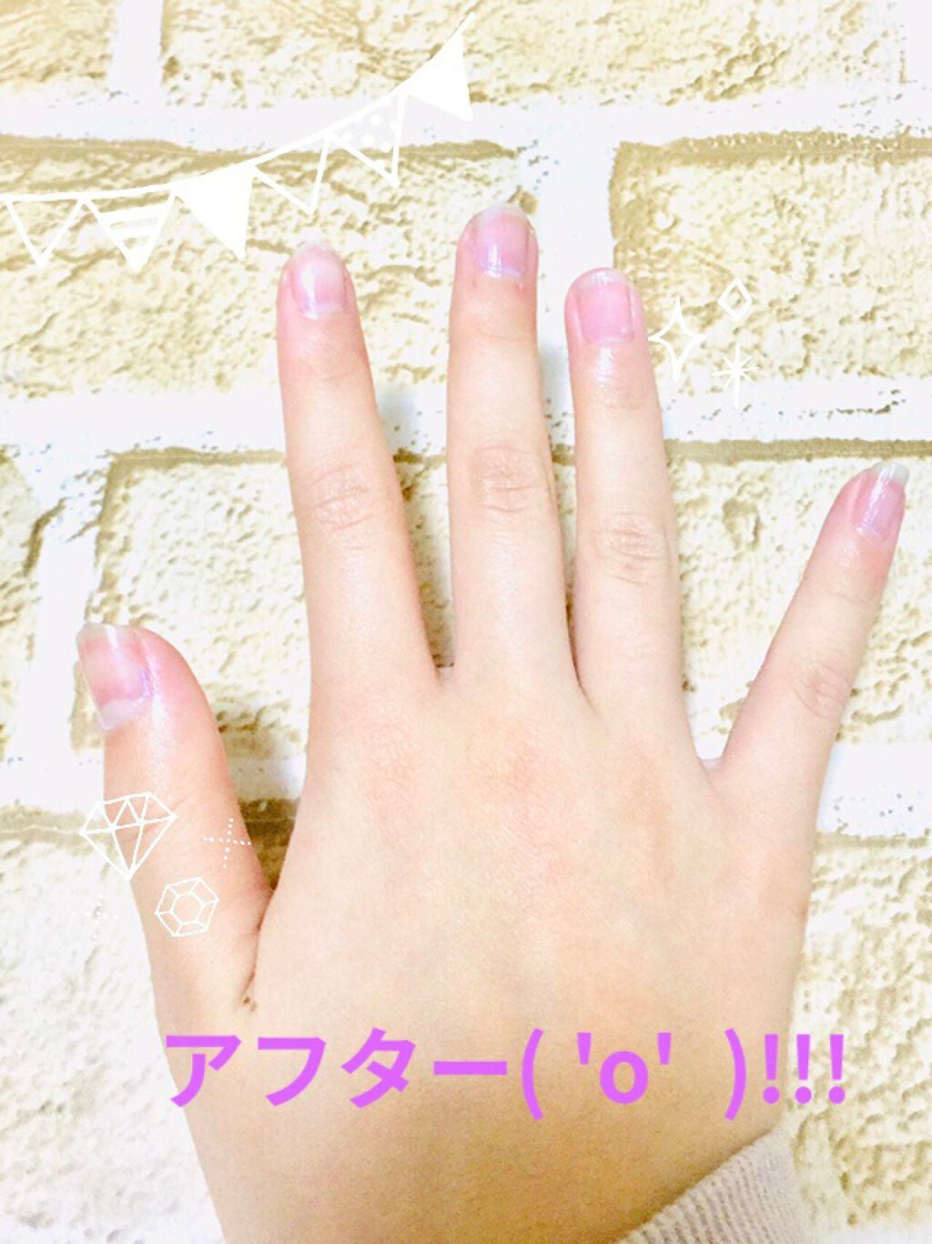 TSネイルリムーバーシート/セリア/除光液を使ったクチコミ(4枚目)
