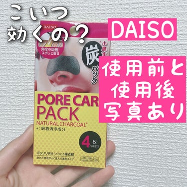 小鼻すっきり炭パック/DAISO/その他スキンケアを使ったクチコミ（1枚目）