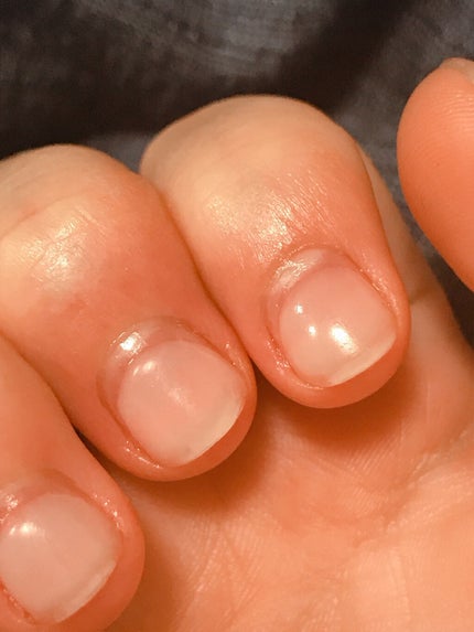 やんちー on LIPS 「あれから2週間経過!ジェルがはがれることもなく、無事に過ごせて..」(4枚目)