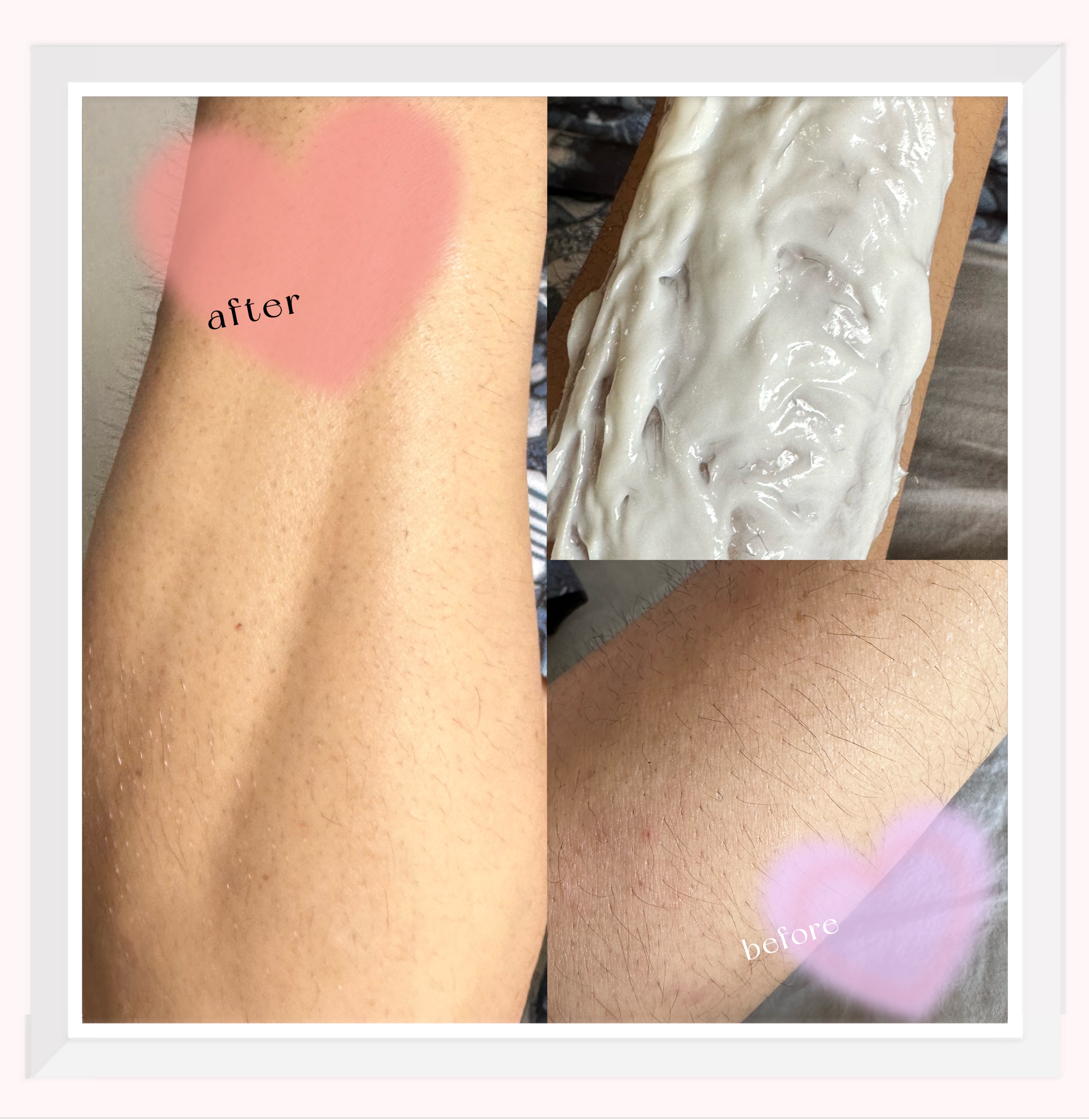 deleMO point Fit/コスモビューティー/除毛クリームを使ったクチコミ（3枚目）