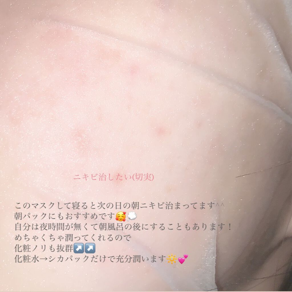 CICA デイリースージングマスク/VT/シートマスク・パックを使ったクチコミ(2枚目)