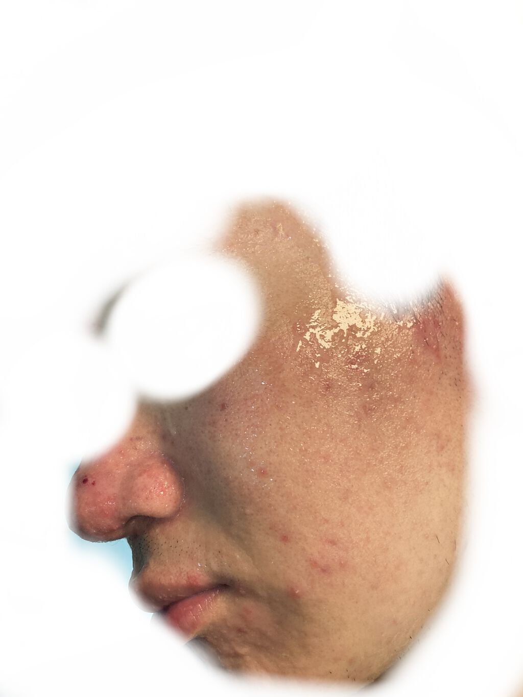 デイリーケアマスク ヒアルロン酸＆グレープフルーツ/RISM/シートマスク・パックを使ったクチコミ（2枚目）