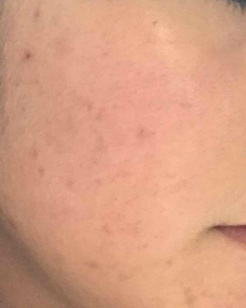 薬用 クリアローション M(しっとりタイプ)/オルビス/化粧水を使ったクチコミ(3枚目)