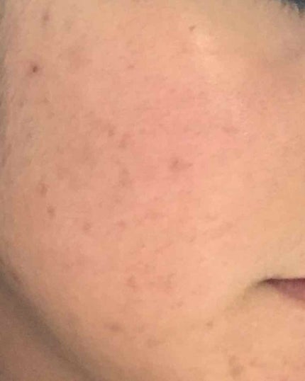 è¬çš ã¯ãªã¢ããŒã·ã§ã³ M(ãã£ãšãã¿ã€ã)/ãªã«ãã¹/åç²§æ°Žã䜿ã£ãã¯ãã³ãïŒ3æç®ïŒ