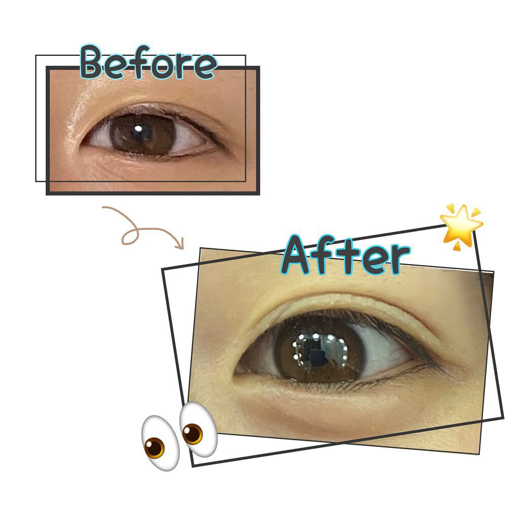 TWOOLダブルアイリッドハイブリットフィルム/SHOBIDO/二重まぶた用アイテムを使ったクチコミ（2枚目）