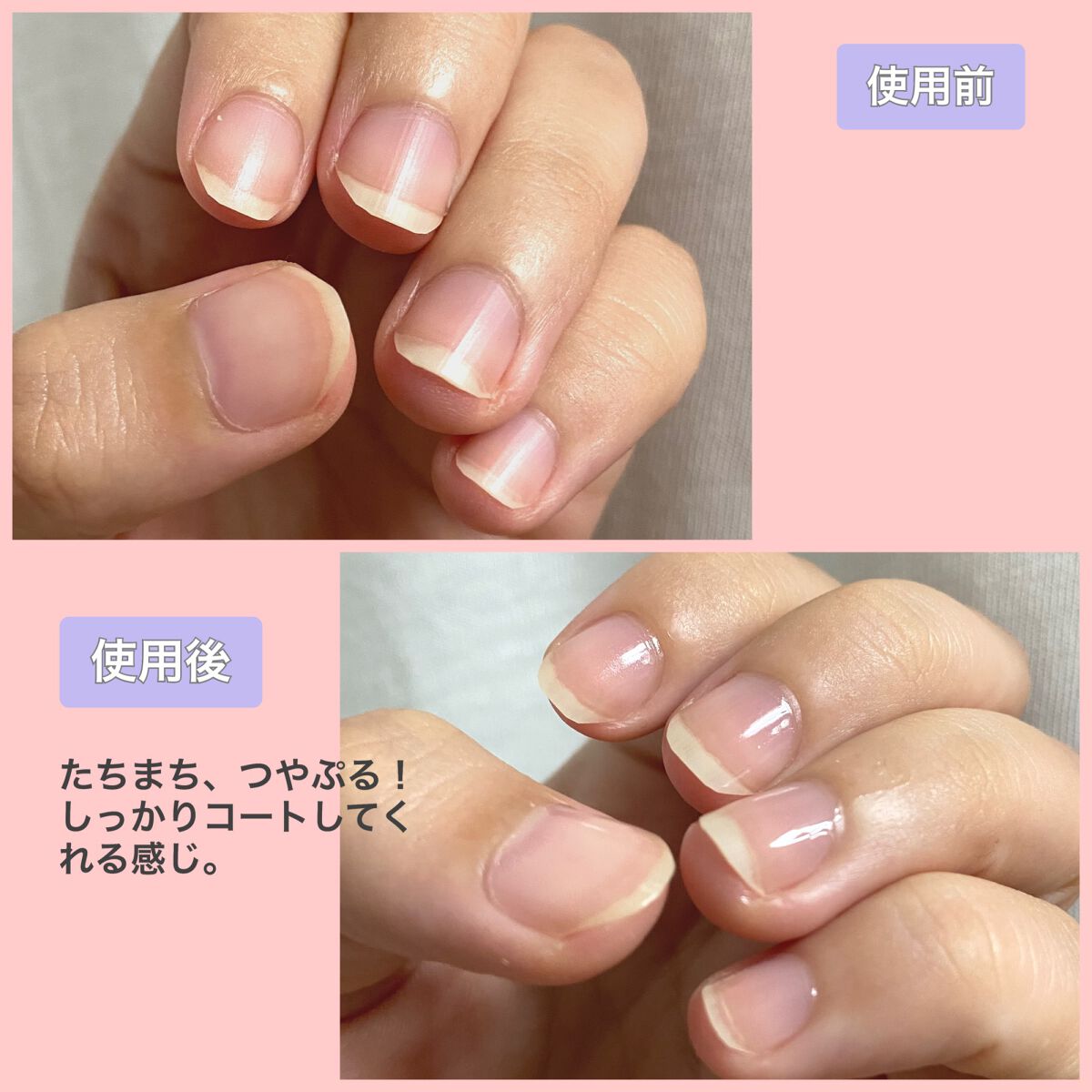 自爪補強コート/デュカート/ネイルベースコートを使ったクチコミ(3枚目)