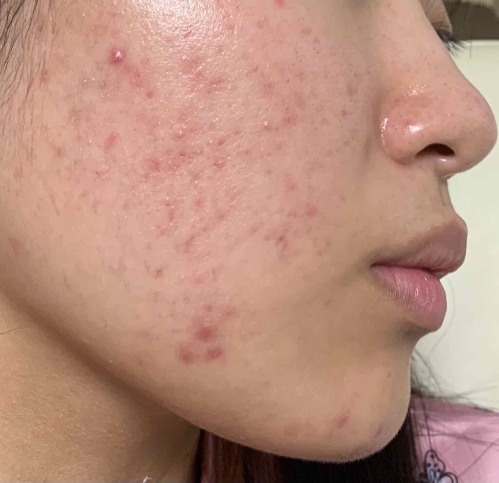 クリアウォッシュ/オルビス/洗顔フォームを使ったクチコミ（3枚目）