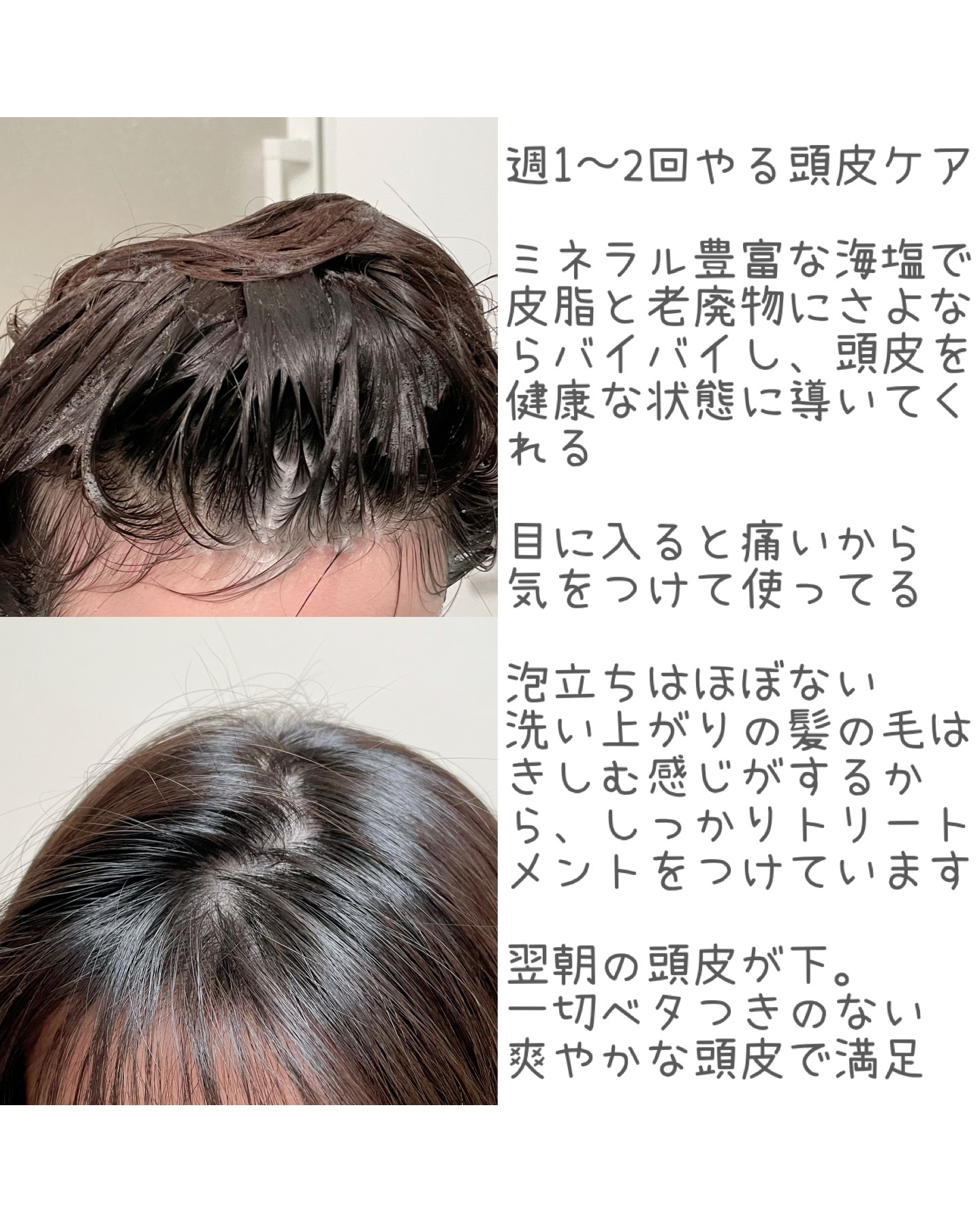 シーソルトセラピースカルプスケーラー/GROWUS/ヘッドスクラブを使ったクチコミ（2枚目）