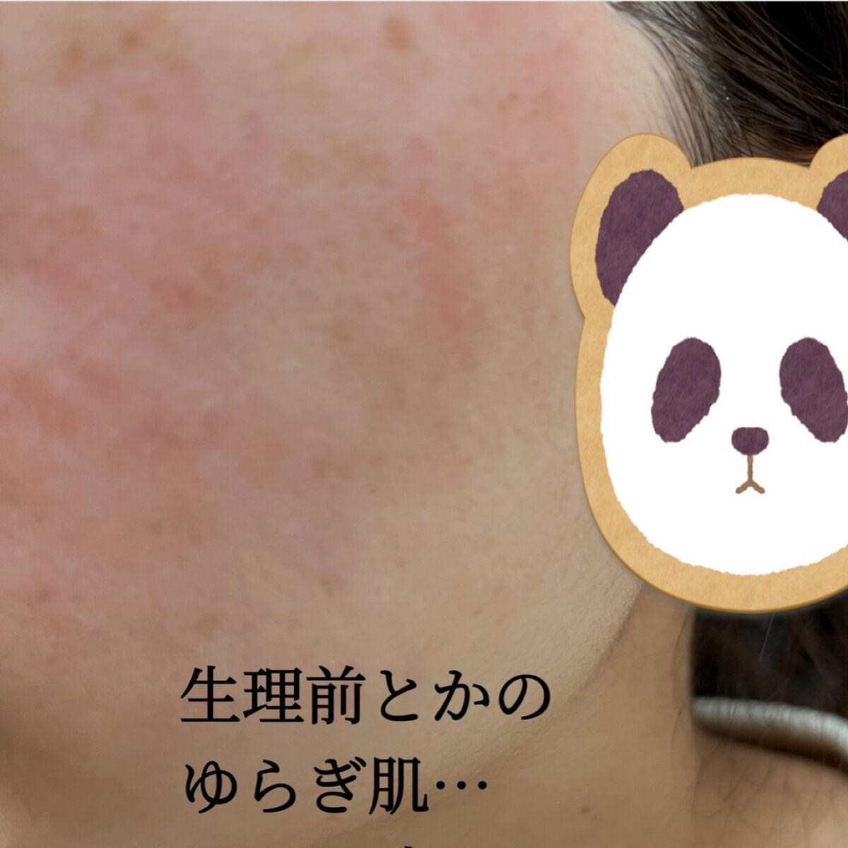 ル・マイルド乳液/ル・マイルド/乳液を使ったクチコミ（2枚目）