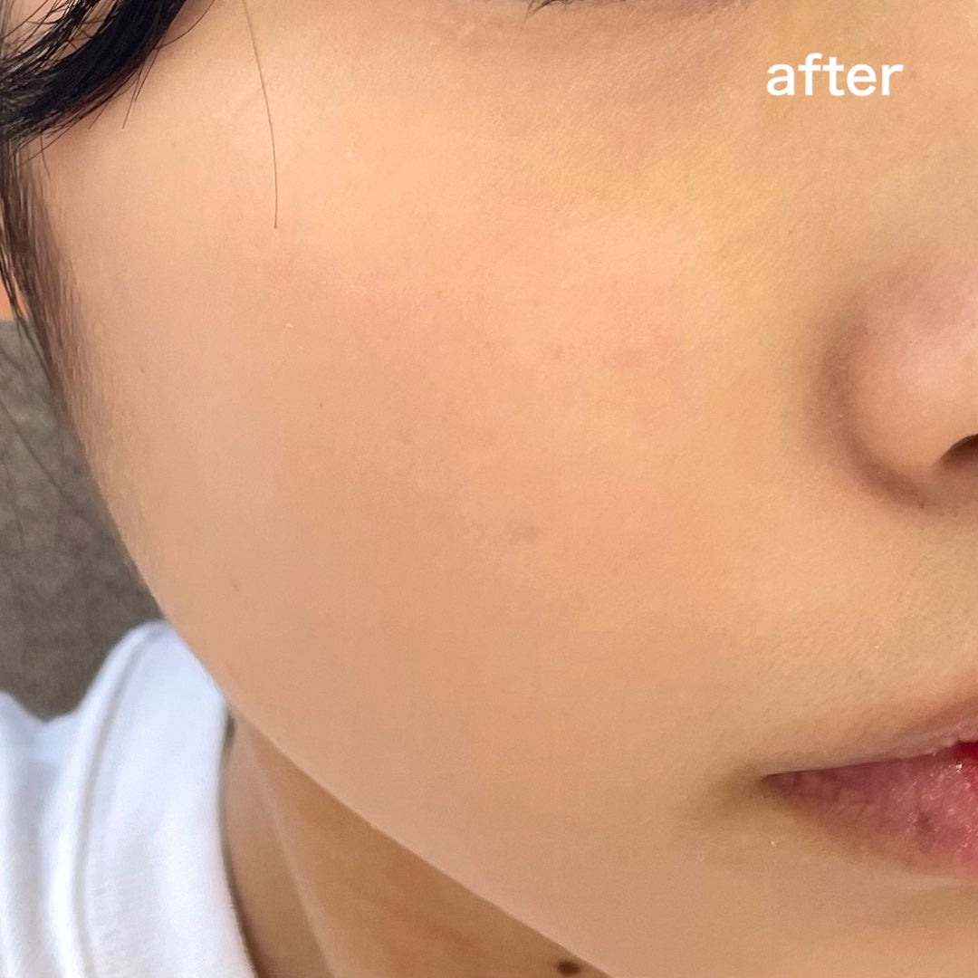 スーパーシカクッション/MEDICUBE/クッションファンデーションを使ったクチコミ(6枚目)