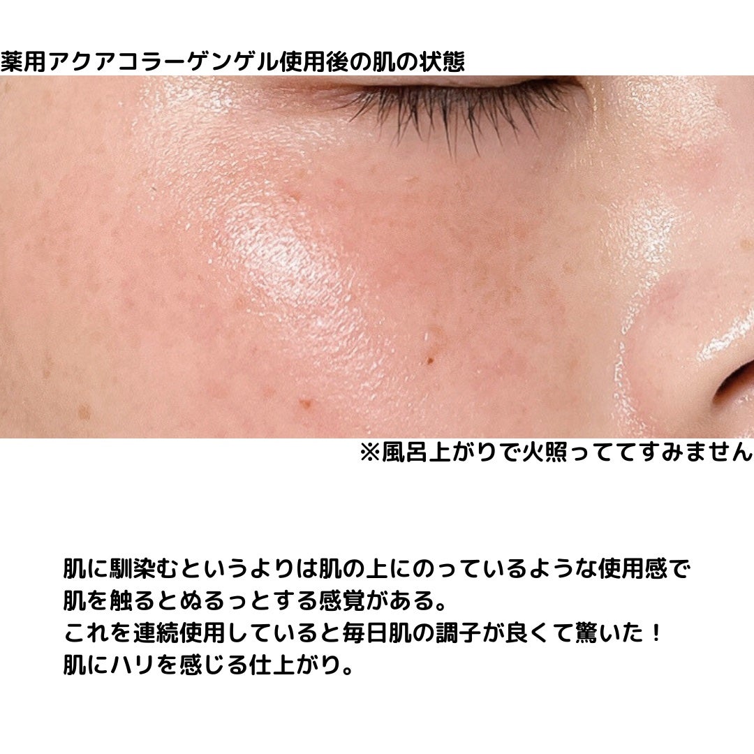 薬用アクアコラーゲンゲル エンリッチリンクルリペア/ドクターシーラボⓇ/フェイスクリームを使ったクチコミ(6枚目)