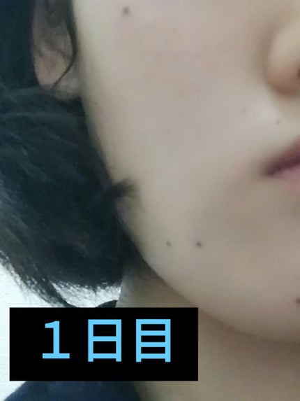 スーパーサンシールド ブライトフィット/ACSEINE/日焼け止めミルクを使ったクチコミ(2枚目)