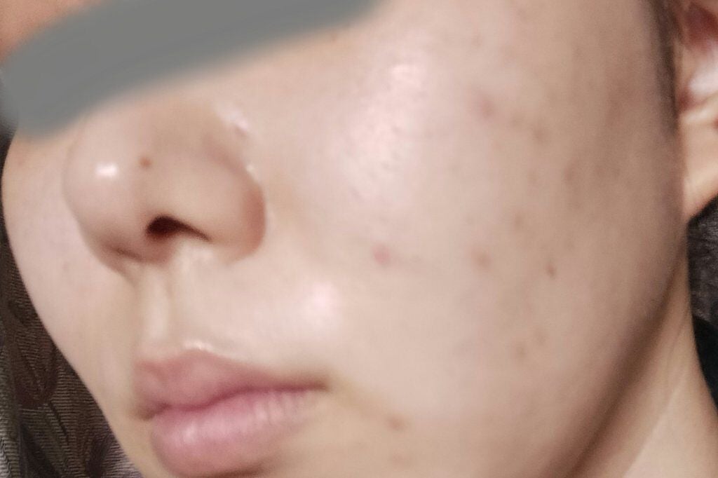 チョコラBBスパークリング/チョコラBB/美容ドリンクを使ったクチコミ(2枚目)