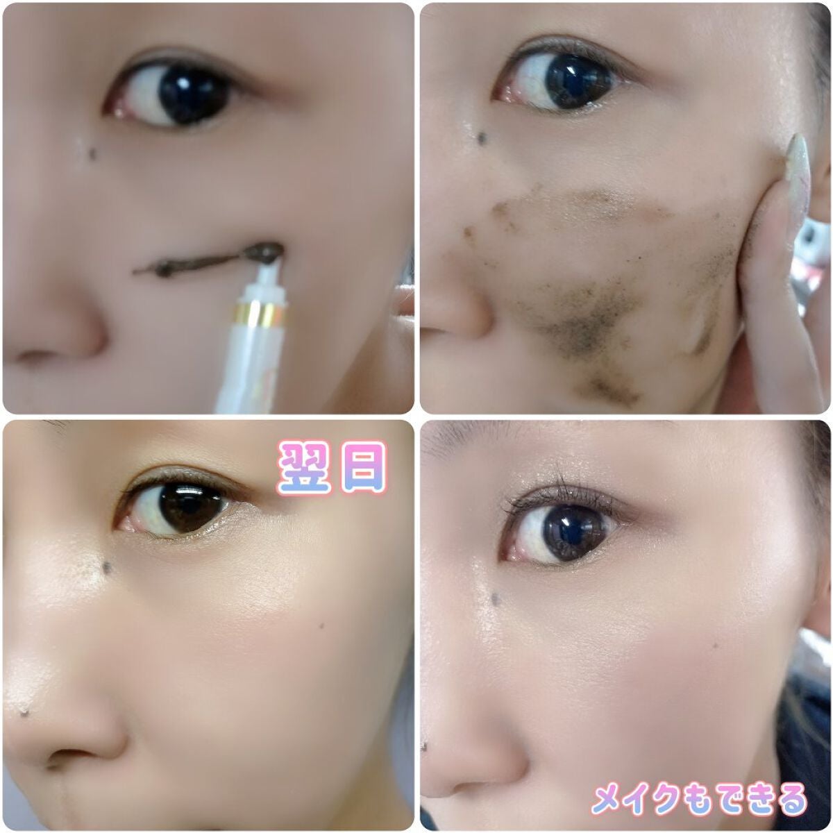 ダーマスキンピーリング/BQCELL/その他キットセットを使ったクチコミ(5枚目)