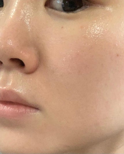 リフレッシングタイムピーリングジェル/reduire /ピーリングを使ったクチコミ(6枚目)