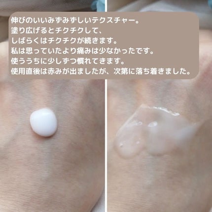 リードルショット300/VT/美容液を使ったクチコミ(3枚目)