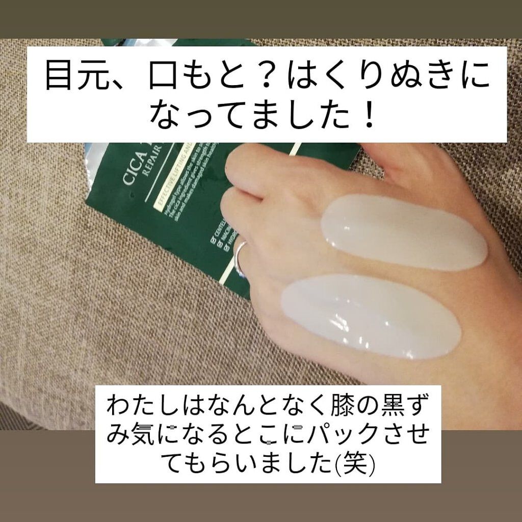 プレミアムシカトリートメントフィッティングマスクパック/WellDerma/シートマスク・パックを使ったクチコミ(4枚目)