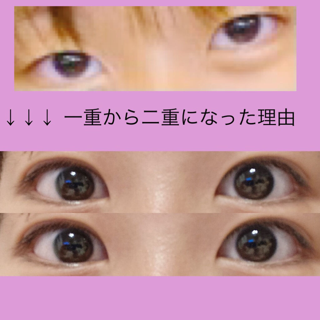 アイビューティー フィクサー WP/アストレア ヴィルゴ/二重まぶた用アイテムを使ったクチコミ（1枚目）