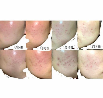 ヘルプミー! ダクトパッド/One-day's you/トナーパッドを使ったクチコミ(2枚目)