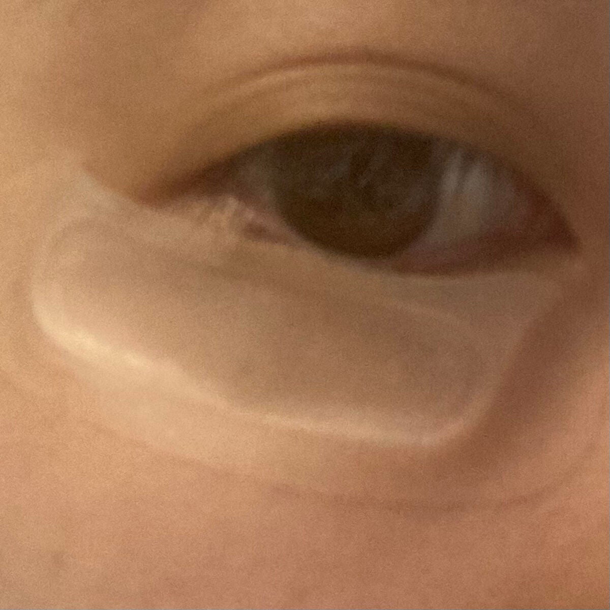 W+ マイクロ ニードル パッチ/SNP/アイケア・アイクリームを使ったクチコミ(7枚目)