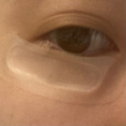 W+ マイクロ ニードル パッチ/SNP/アイケア・アイクリームを使ったクチコミ(7枚目)