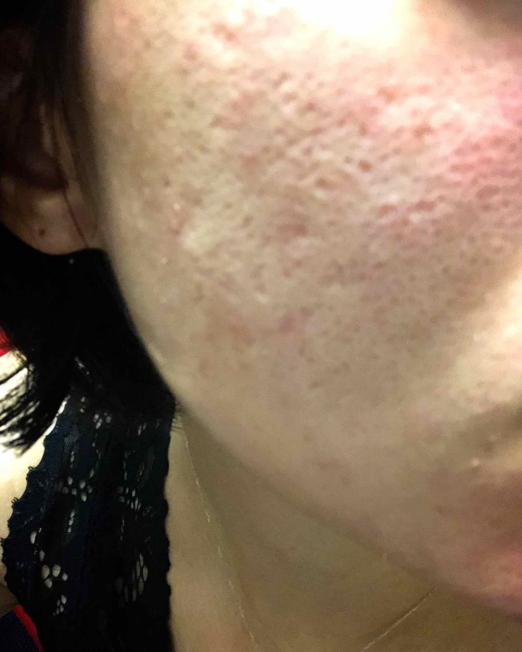 7 day Special Set プログラム3/b.glen/トライアルキットを使ったクチコミ(3枚目)