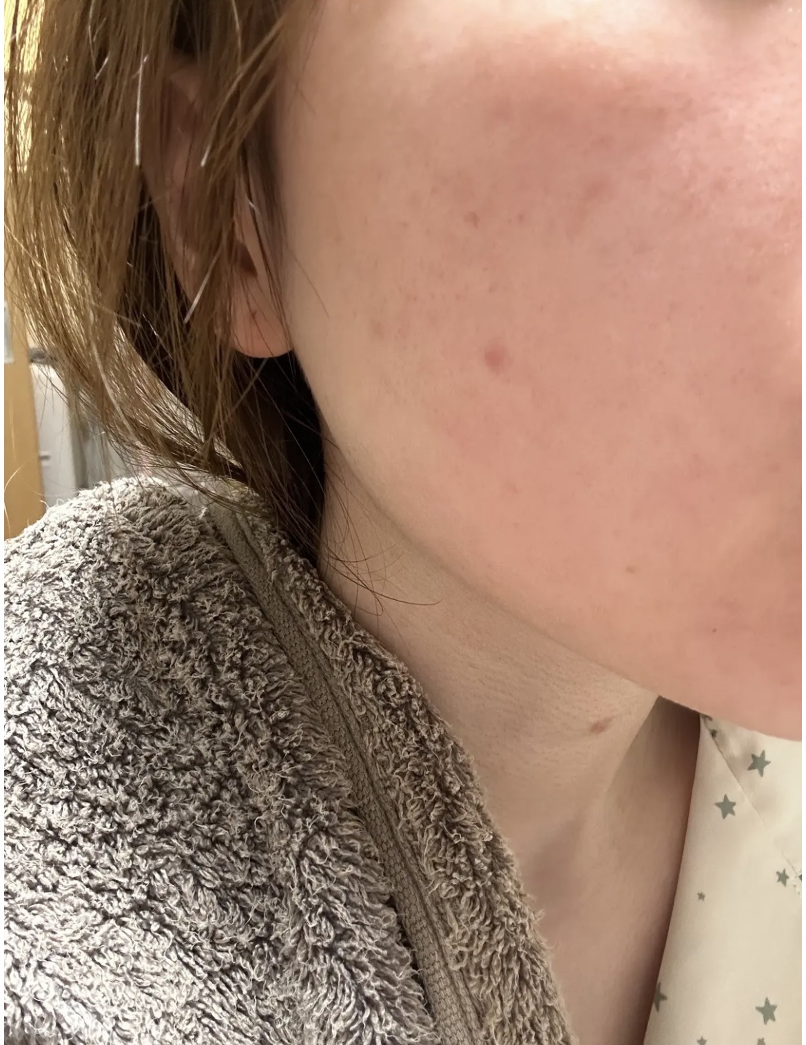 ベリーお元気？/ラッシュ/洗い流すパック・マスクを使ったクチコミ（1枚目）