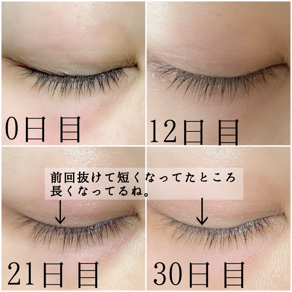 EMAKED まつ毛美容液 眼科医監修 EMAKED まつ毛美容液 眼科医監修 EMAKED(エマーキット)|水橋