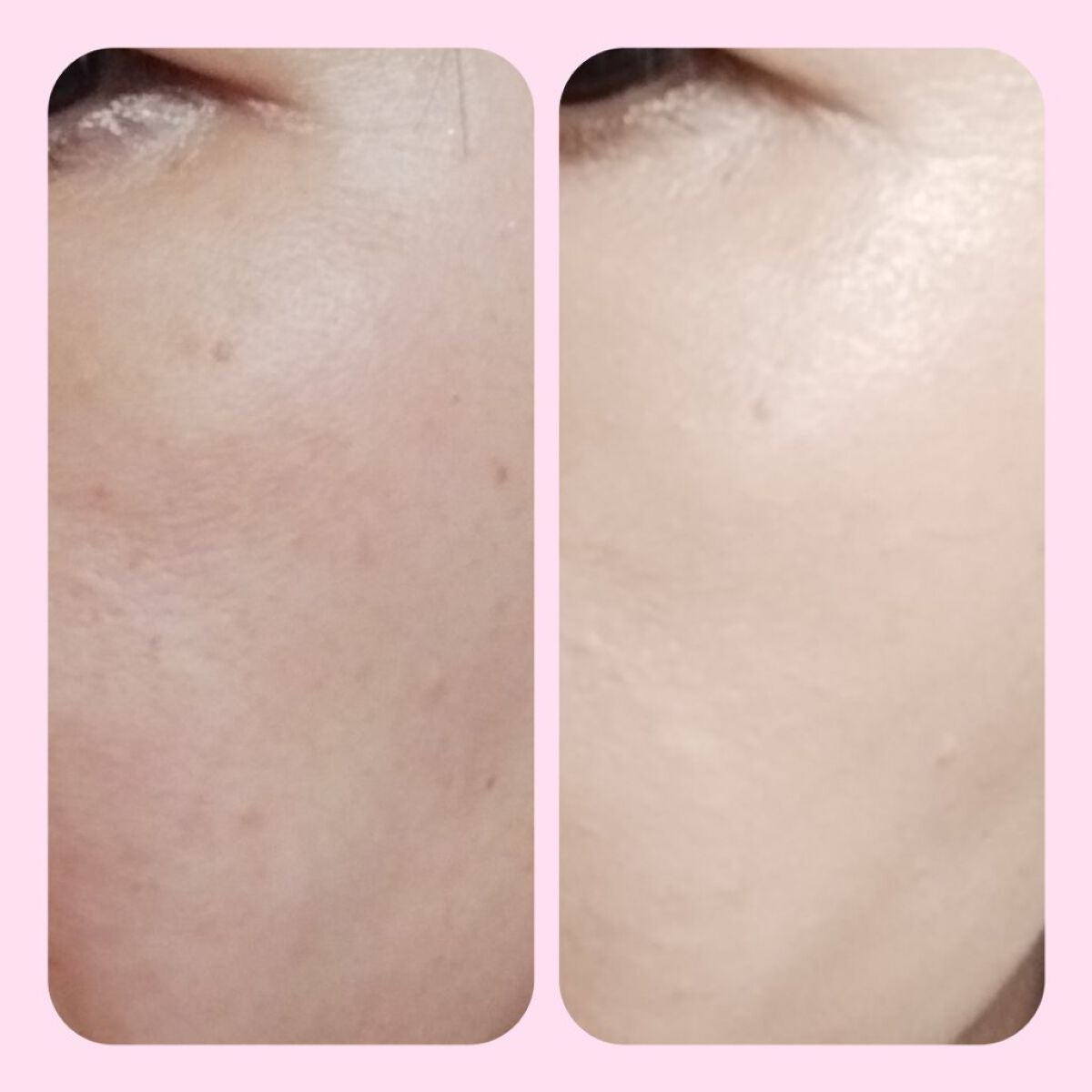 シピシピ フィットスキンクッション/CipiCipi/クッションファンデーションを使ったクチコミ(3枚目)