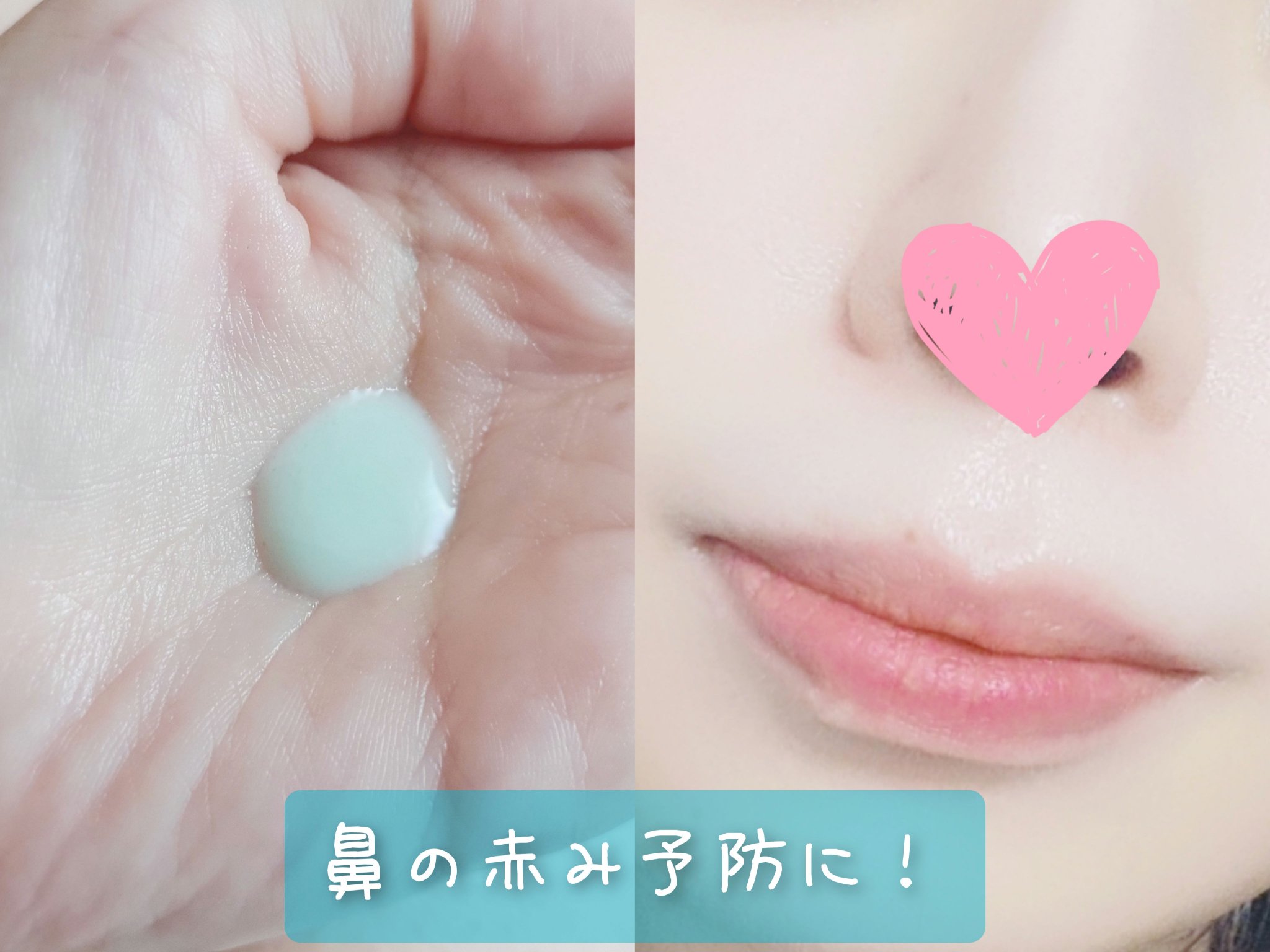 カプチュール ユース レッドネス ミニマイザー/Dior/美容液を使ったクチコミ（2枚目）